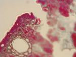 MISSING THUMBNAIL